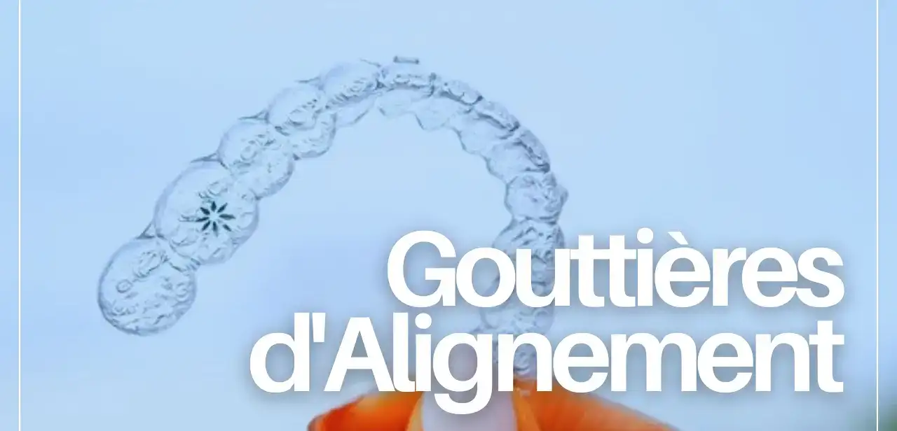 Close-up of a transparent gouttière d’alignement dentaire (clear aligner) being held up, showcasing its flexible and invisible design for effective teeth straightening.