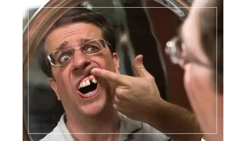 Homme examinant une dent tombée devant un miroir, illustrant la perte dentaire due à des maladies ou accidents.