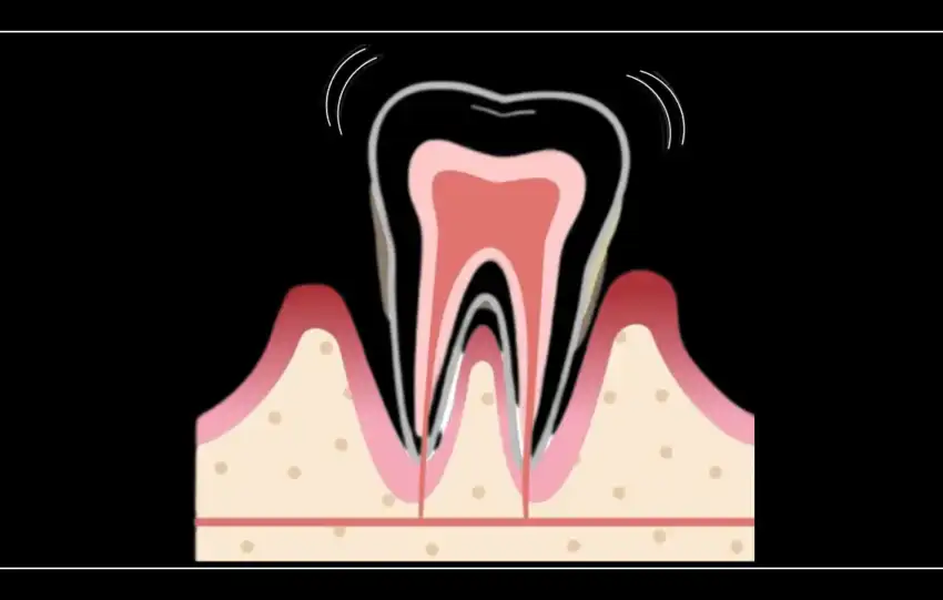 Illustration avec une dent mobile et le texte "Mes dents bougent! Quoi faire ?" pour introduire les causes et solutions d’une dent qui bouge. Par Le Bord Libre.
